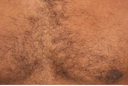 Hairy Skins